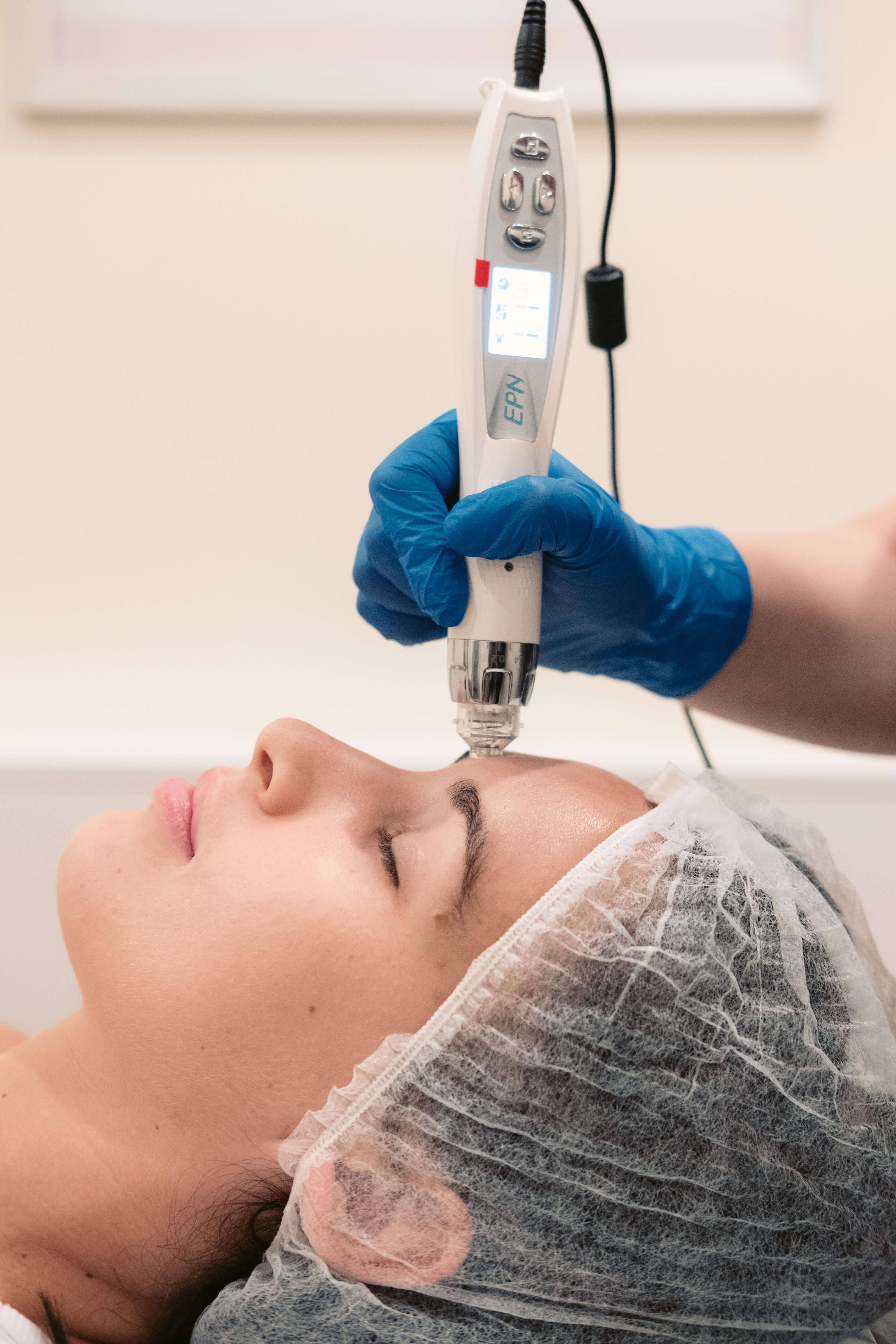 Skin Needling Treatments Derma Needling & Derma Pen Treatment