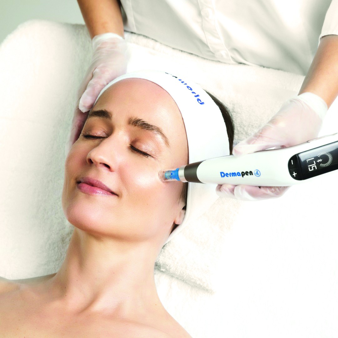 Why Skin Needling Works Differently at 25 Vs 45